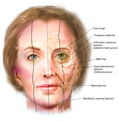 Facial Rejuvenation versus the Aging Face through Surgical and Non-surgical Plastic surgery bluffton sc